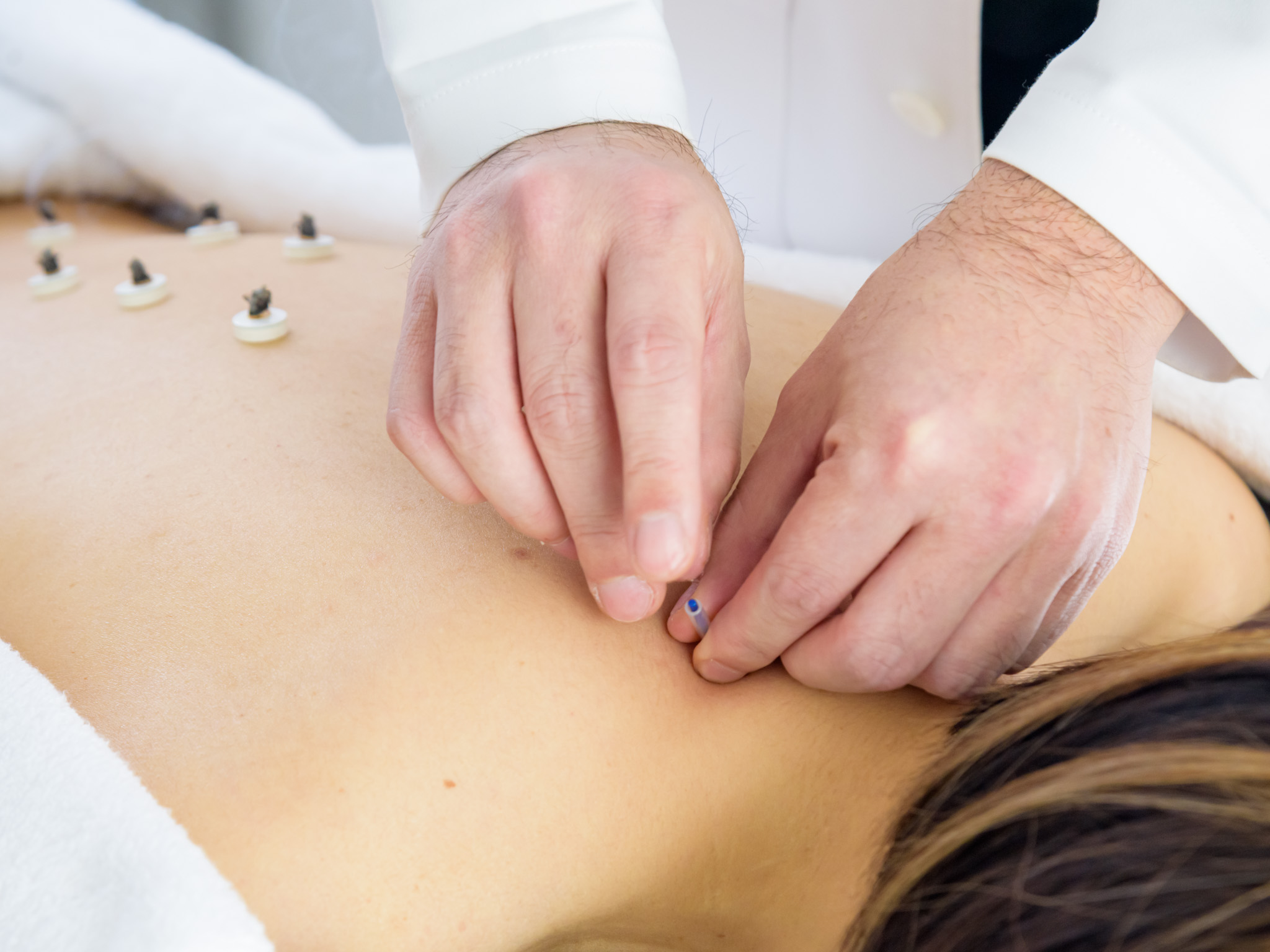 神経系の症状イメージ