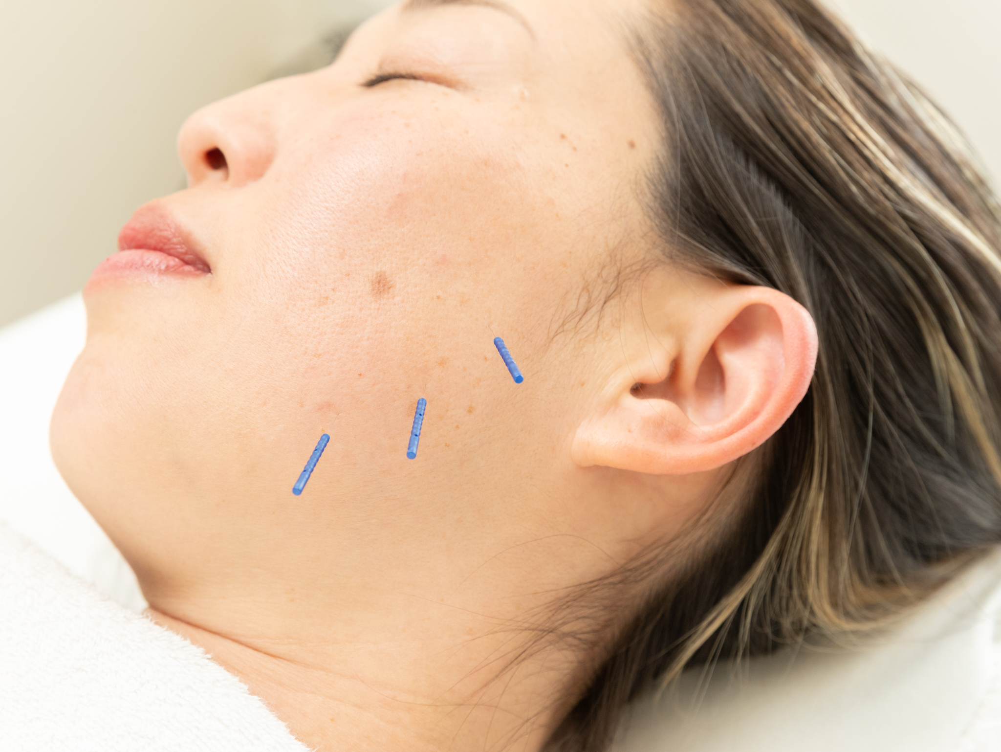 鍼は前立腺肥大症に効く?効果とメカニズムを研究で解説|藤沢の鍼灸