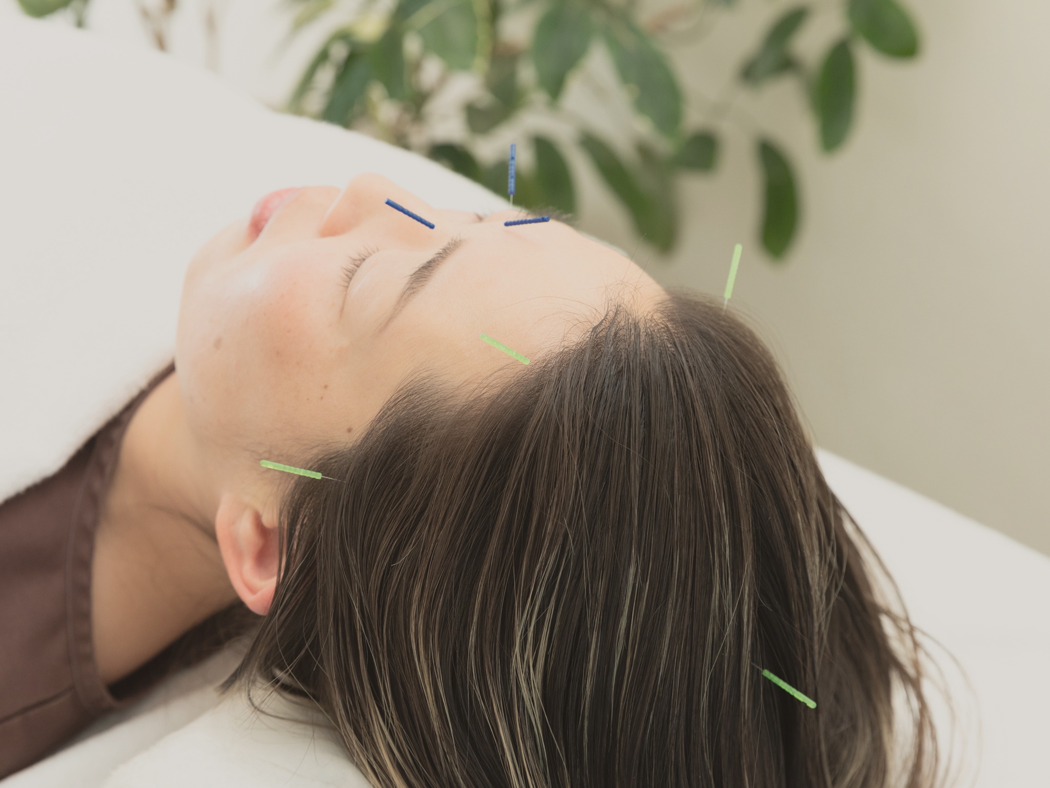 生理痛の薬(鎮痛薬・低用量ピル・漢方)との付き合い方と鍼灸の併用|藤沢の鍼灸