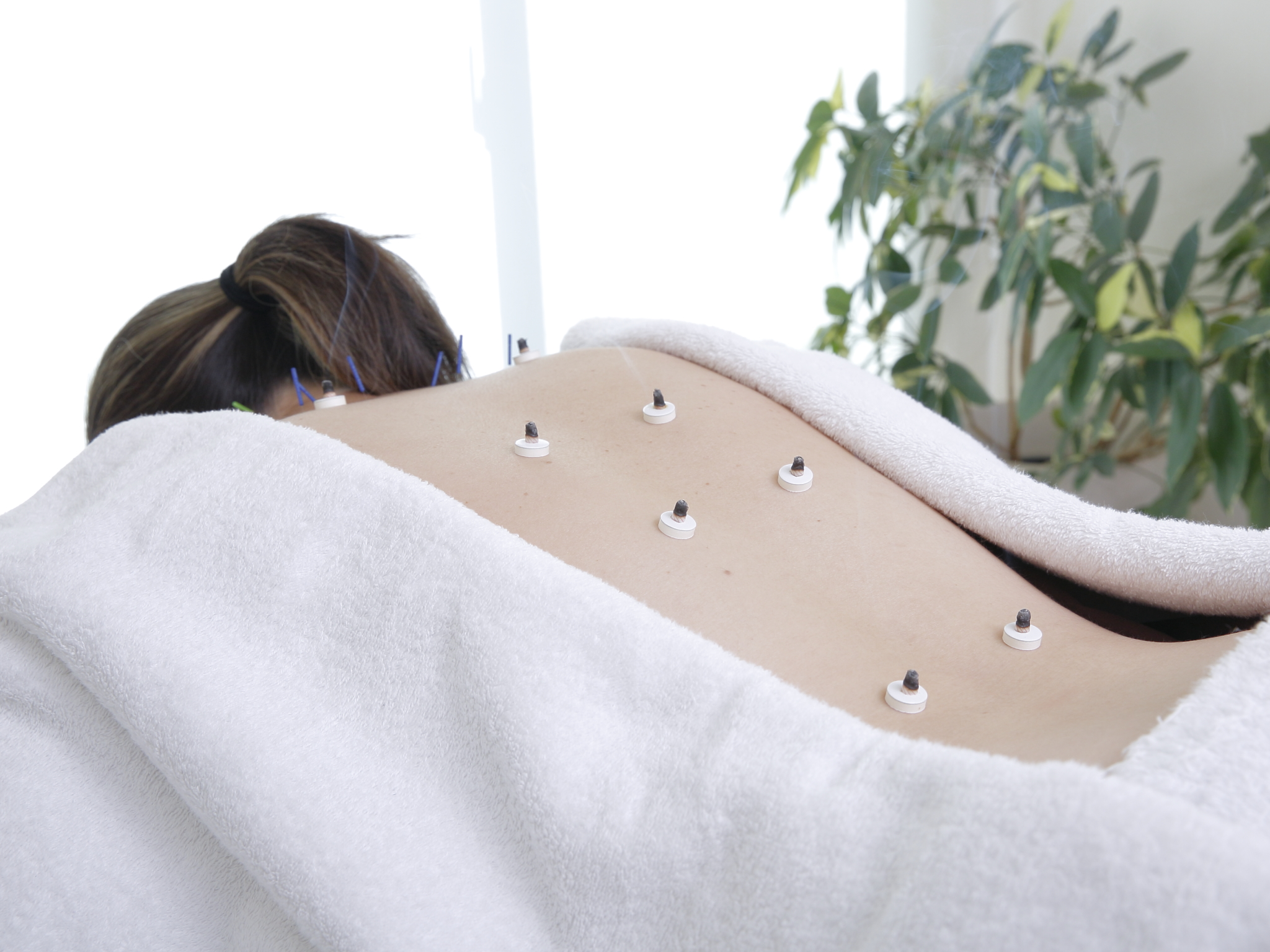 更年期の鍼灸はどのくらい通う？頻度・期間の目安と続け方｜藤沢の鍼灸