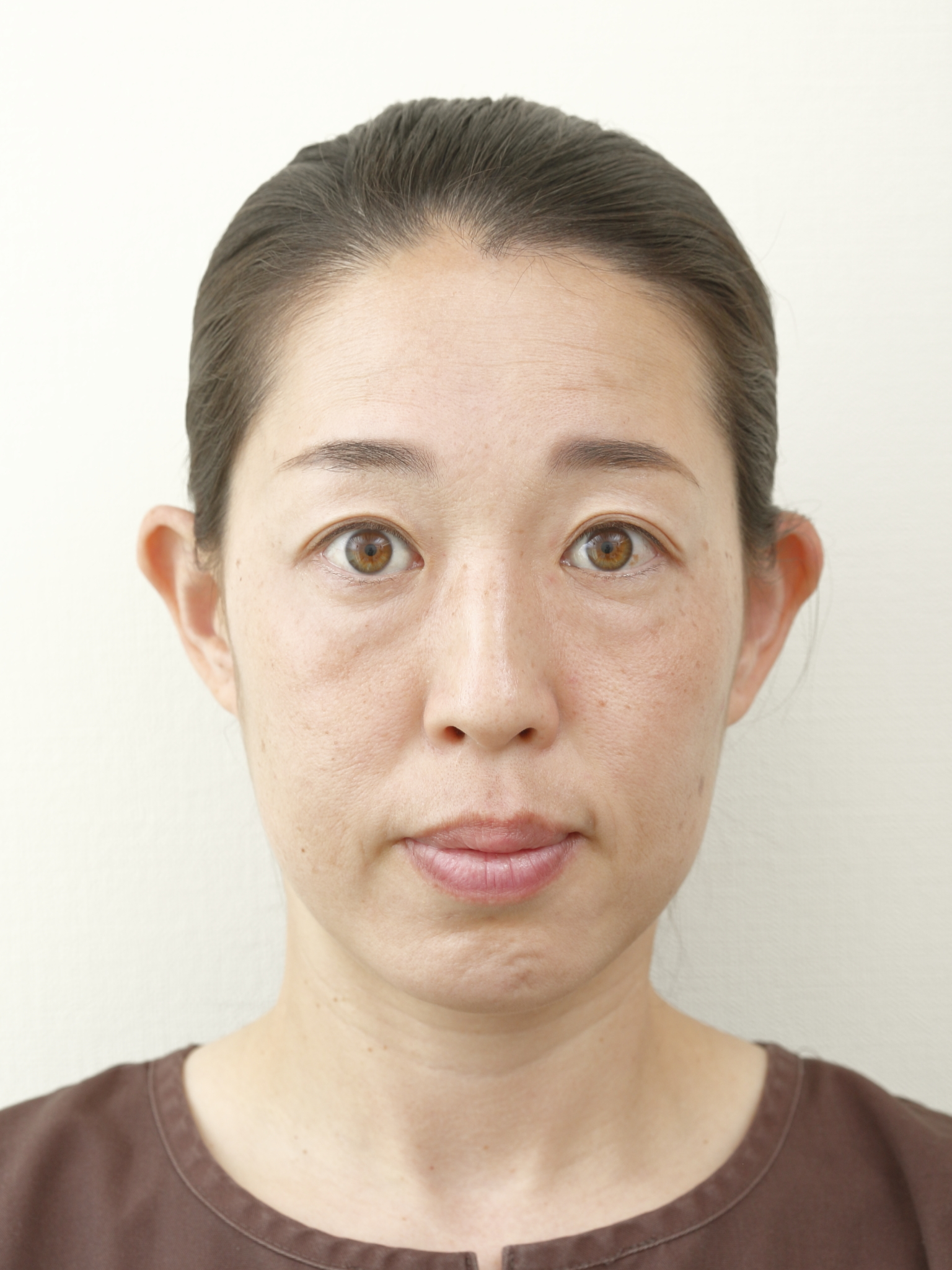 自律神経の鍼灸は何回で変わる?通院回数と料金の目安|藤沢の鍼灸