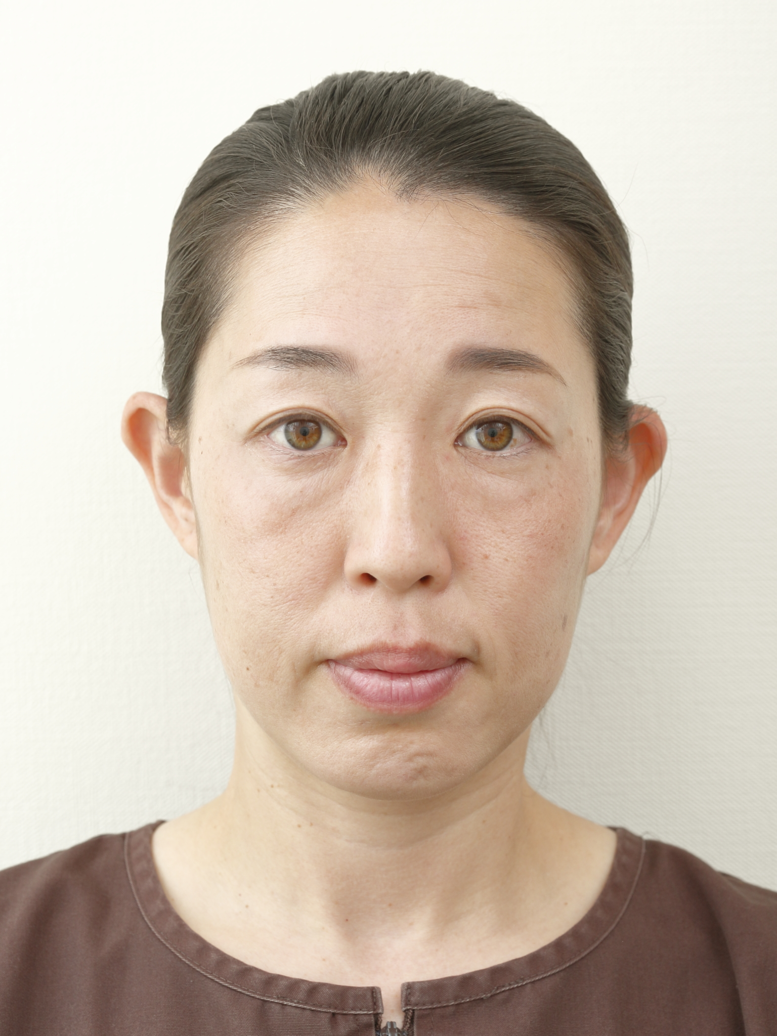 【エビデンス】鍼は前立腺肥大症に効く?研究とデータで総まとめ|藤沢の鍼灸